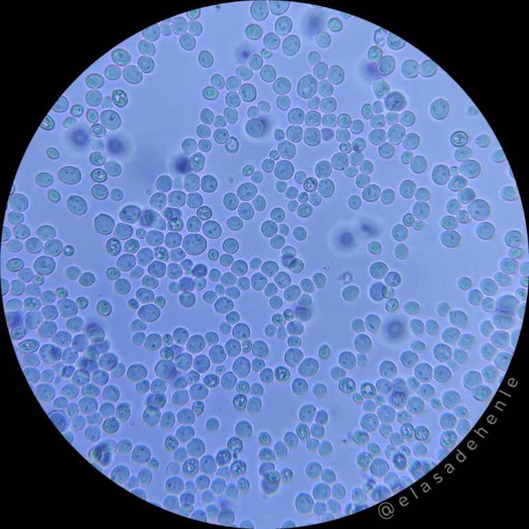 ¿Cómo podemos observar levaduras con microscopio óptico? – El asa de Henle